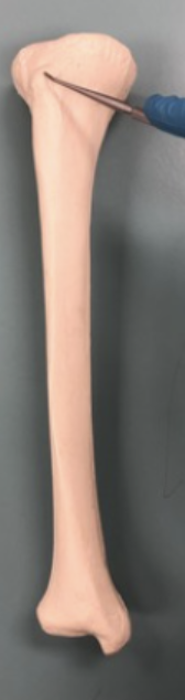 <p><span style="font-family: -apple-system, system-ui, Segoe UI, Roboto, Helvetica Neue, Arial, Noto Sans, Liberation Sans, sans-serif, Apple Color Emoji, Segoe UI Emoji, Segoe UI Symbol, Noto Color Emoji">Identify this feature.&nbsp;</span></p>