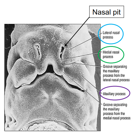 <p>fusion of the lateral nasal, maxillary and medial nasal processes </p>