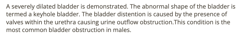 <p>d) most likely a male fetus</p>