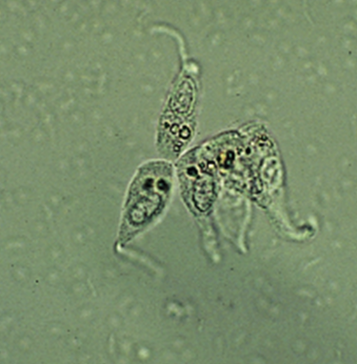<ol start="48">
<li>What does a Caudate epithelial cell look like?</li>
</ol>