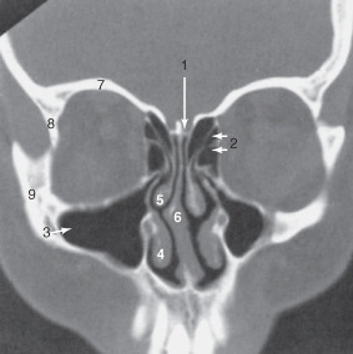 <p>the zygoma is labeled:</p>