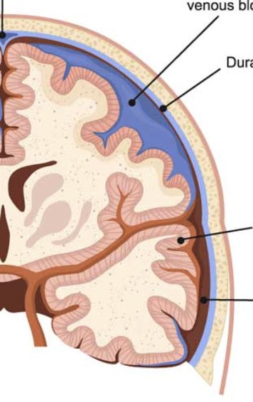 <p>serious accumulation of blood between the brain's surface and its outer covering</p>