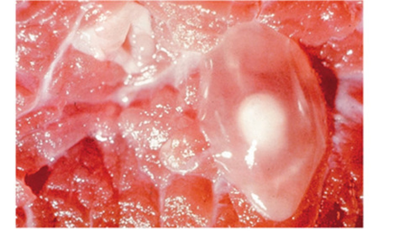 <p>Taenia Saginata is the beef tapeworm of humans. However, since the cow is the intermediate host, it has a genus and species name for the metacestode stage. These organs genus and species of the metacestode stage of the beef tapeworm is</p>