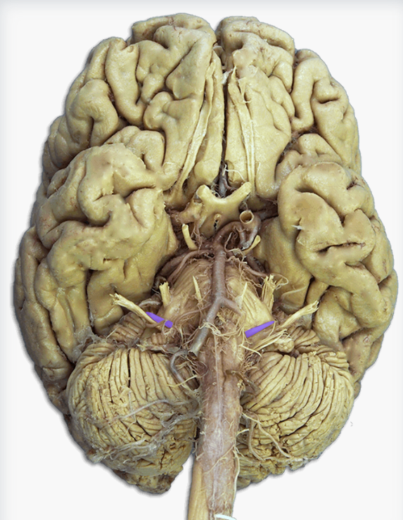 <p>Label this cranial nerve</p>