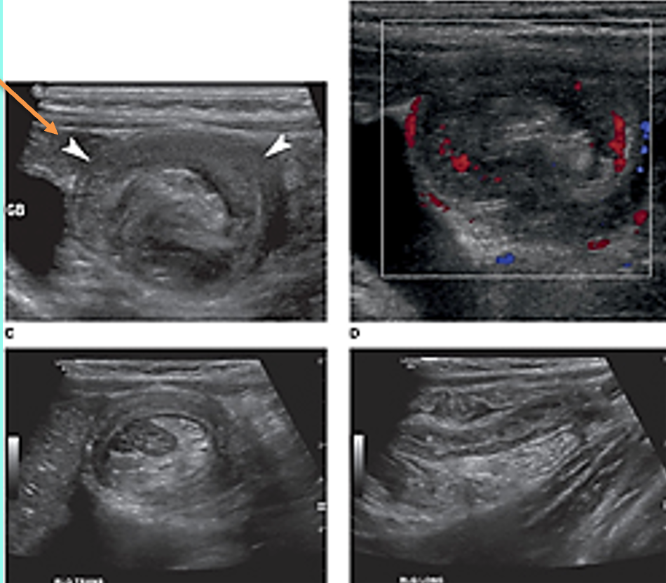 <p>what is shown?</p>