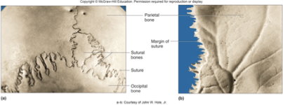 <p>fibrous</p><ul><li><p>between flat bones of skull</p></li><li><p>thin layer of connective tissue sutural ligament) connects bones</p></li><li><p>synarthrotic (immovable) </p></li><li><p>chiropractors can put pressure on but can’t move</p></li></ul><p></p>