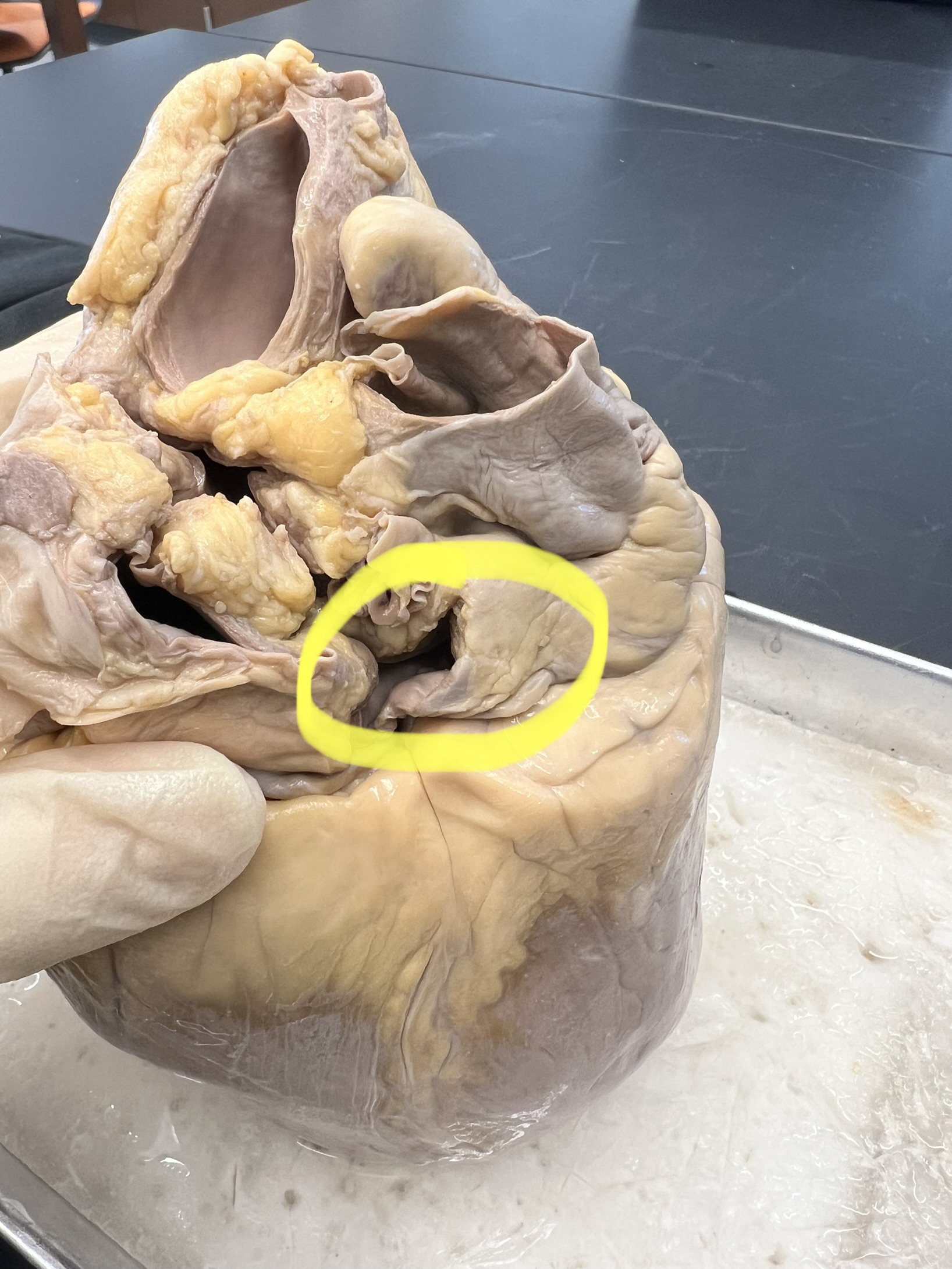 Name the heart structure.