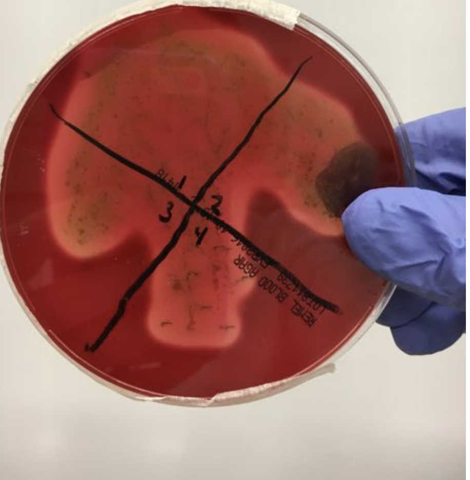 <p>If you got these results in the blood agar test what do you do next?</p>