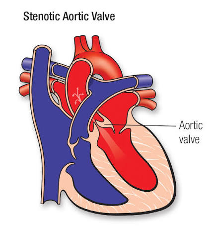 <p><span>A: Controls blood flow between the left ventricle and aorta.</span></p>