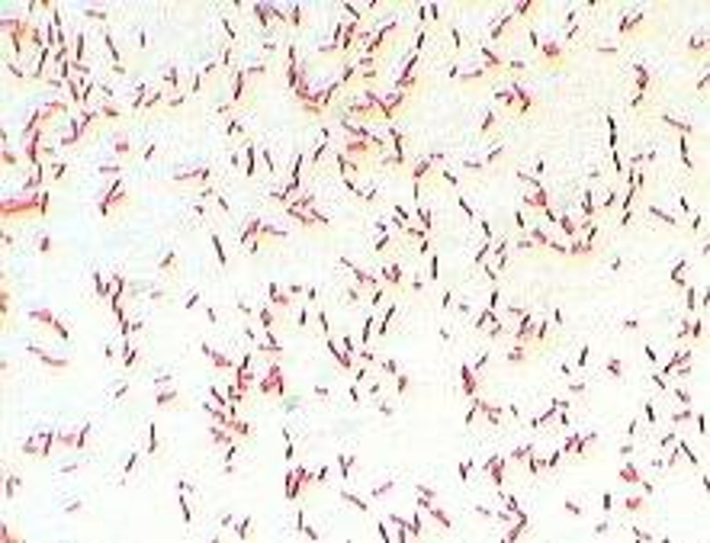 <p>Gram negative coccibacillus</p><p>Affects the respiratory system</p><p>Causes dry cough, nasal discharge</p><p>Spreads in kennels and shelters</p>