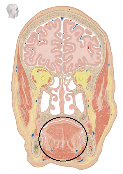 term image