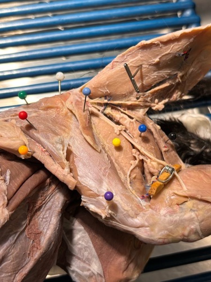 <p>What thigh muscle is the orange pin in</p>