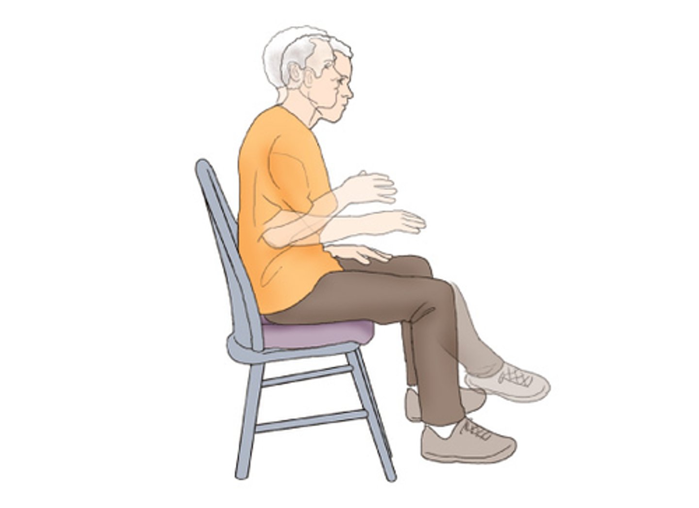 <p>- within 2 months med therapy</p><p>- med can still be continued even if symptoms progress</p><p>causes =</p><p>- uncontrolled constant movements</p><p>- restlessness</p>
