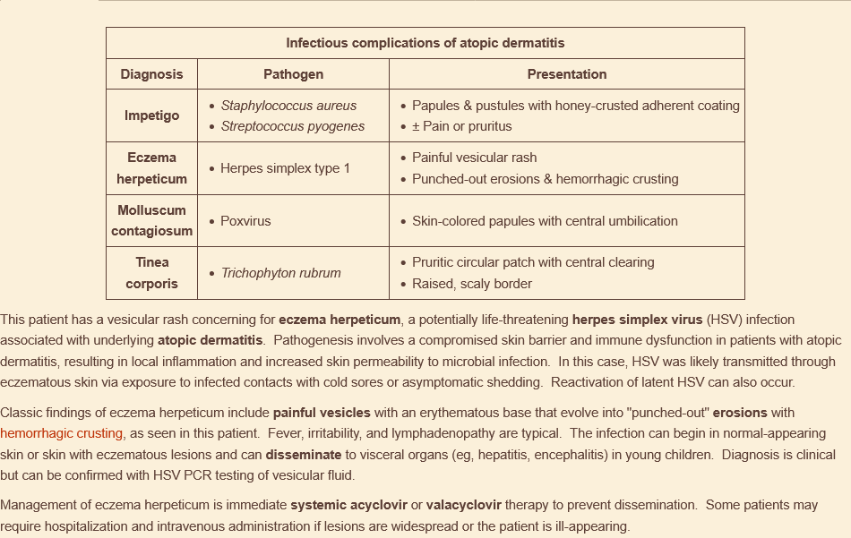 <p>eczema herpeticum</p><p></p>