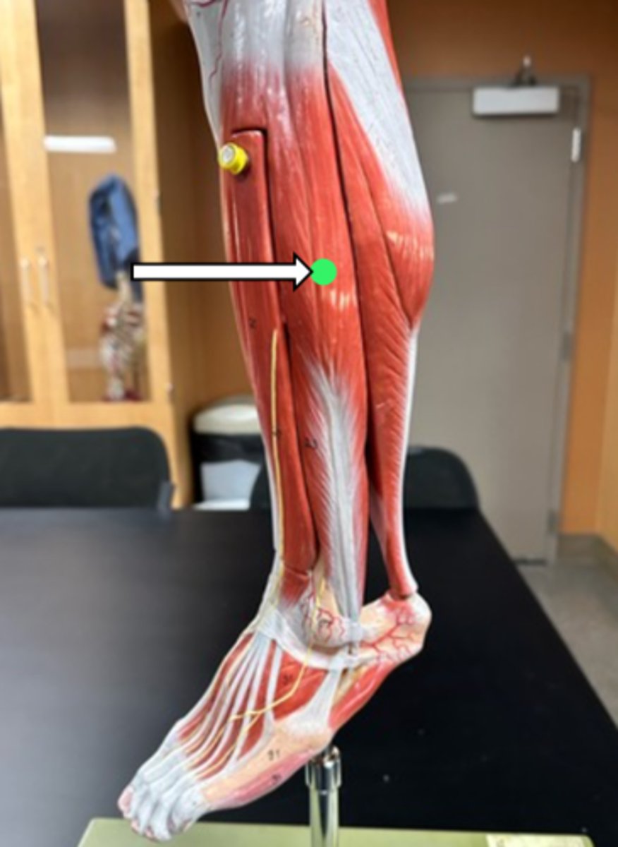 <p>fibularis longus (function)</p>