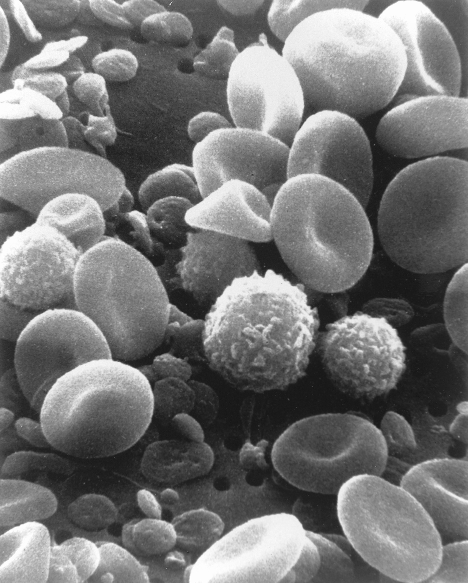 <p>Explain which microscope produced this image?</p>