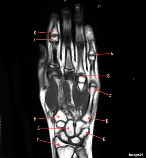 <p>Letter C is pointing to </p>
