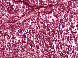 <p>Framework of internal orangans spleen and liver </p>