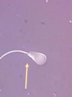 <p>Identify the sperm morphology.</p>