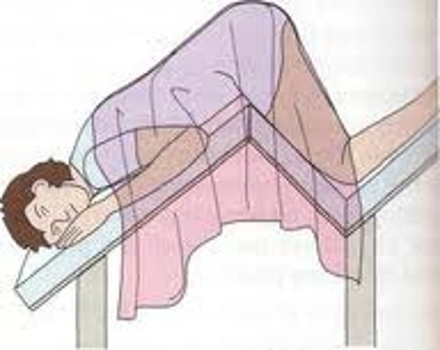 <p>patient lies on stomach w/ the head &amp; legs inclined downward &amp; rectal area elevated</p>