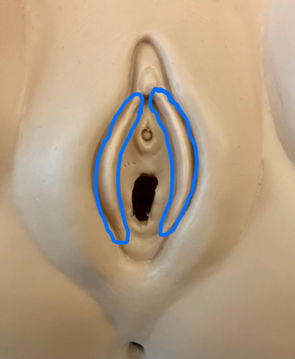 <p>ID Structure outlined in Blue</p>