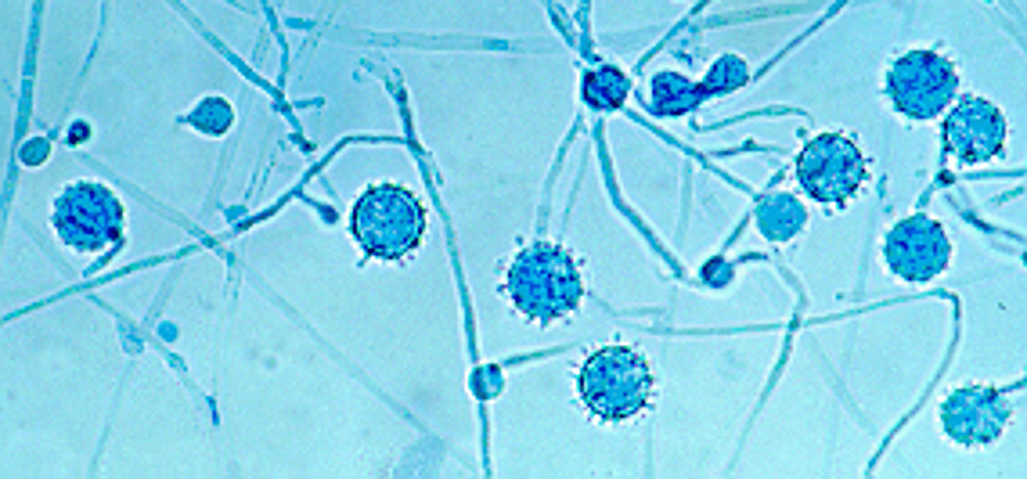 <p>Rapid; 2-3 days</p><p>Waxy, white, velvety lemon color with age</p><p>Reverse: white</p><p>Microscopic: thick walled, round macroconidia; differentiate from Histoplasma by lack of yeast phase (37 C)</p><p>Conditions: n/s, contaminant</p>