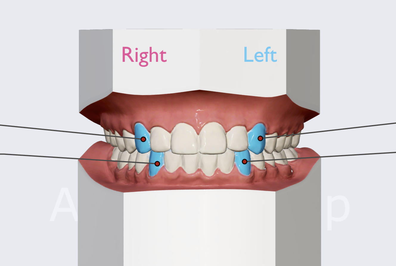 <p>Name the teeth highlighted in blue.</p>
