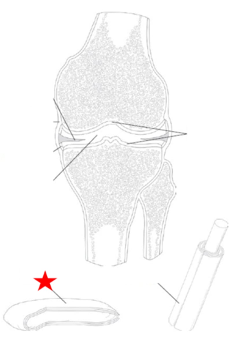 <p>Identify the synovial joint structure that the star is pointing to.</p>
