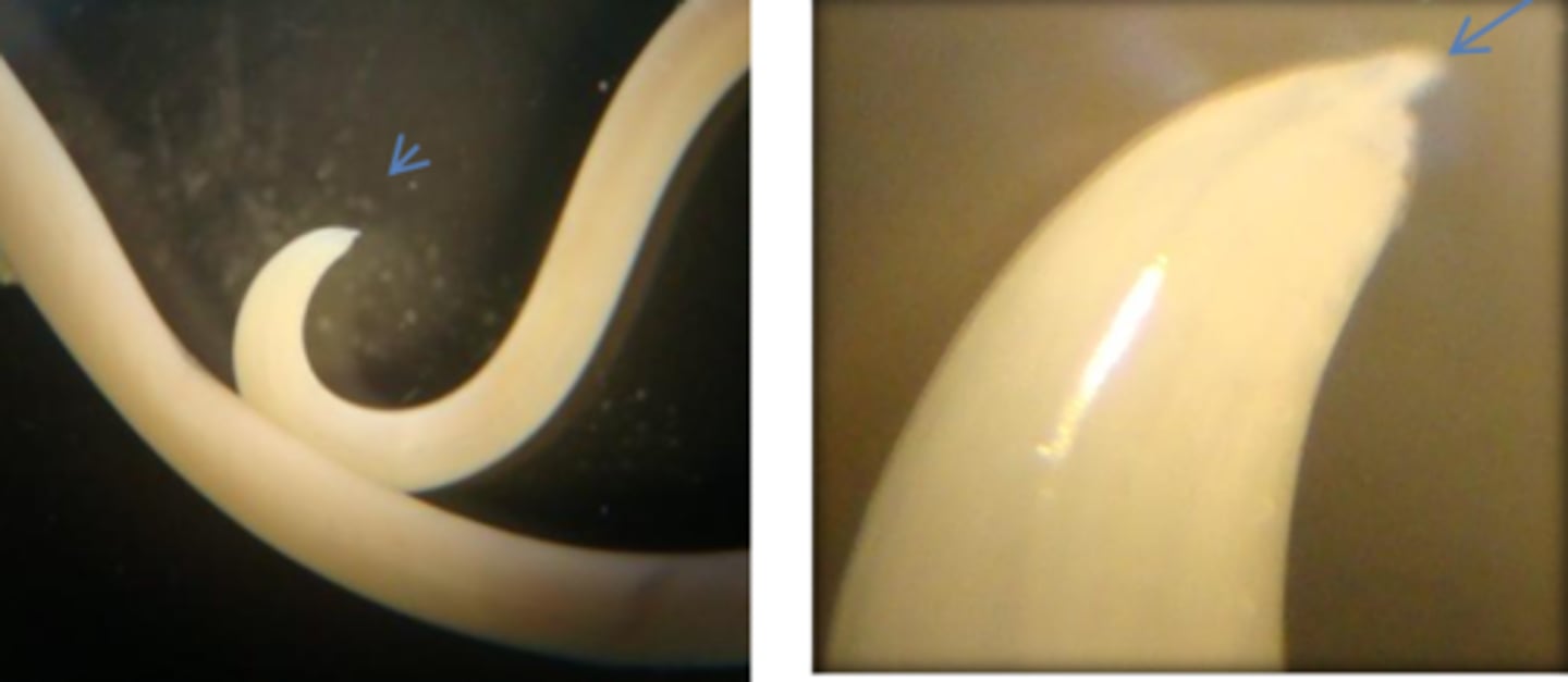 <p>Found in a dog with persistent coughing and poor weight gain. What parasite is this?</p>