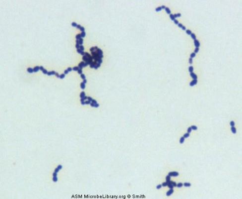 Identify the gram reaction, shape and arrangement