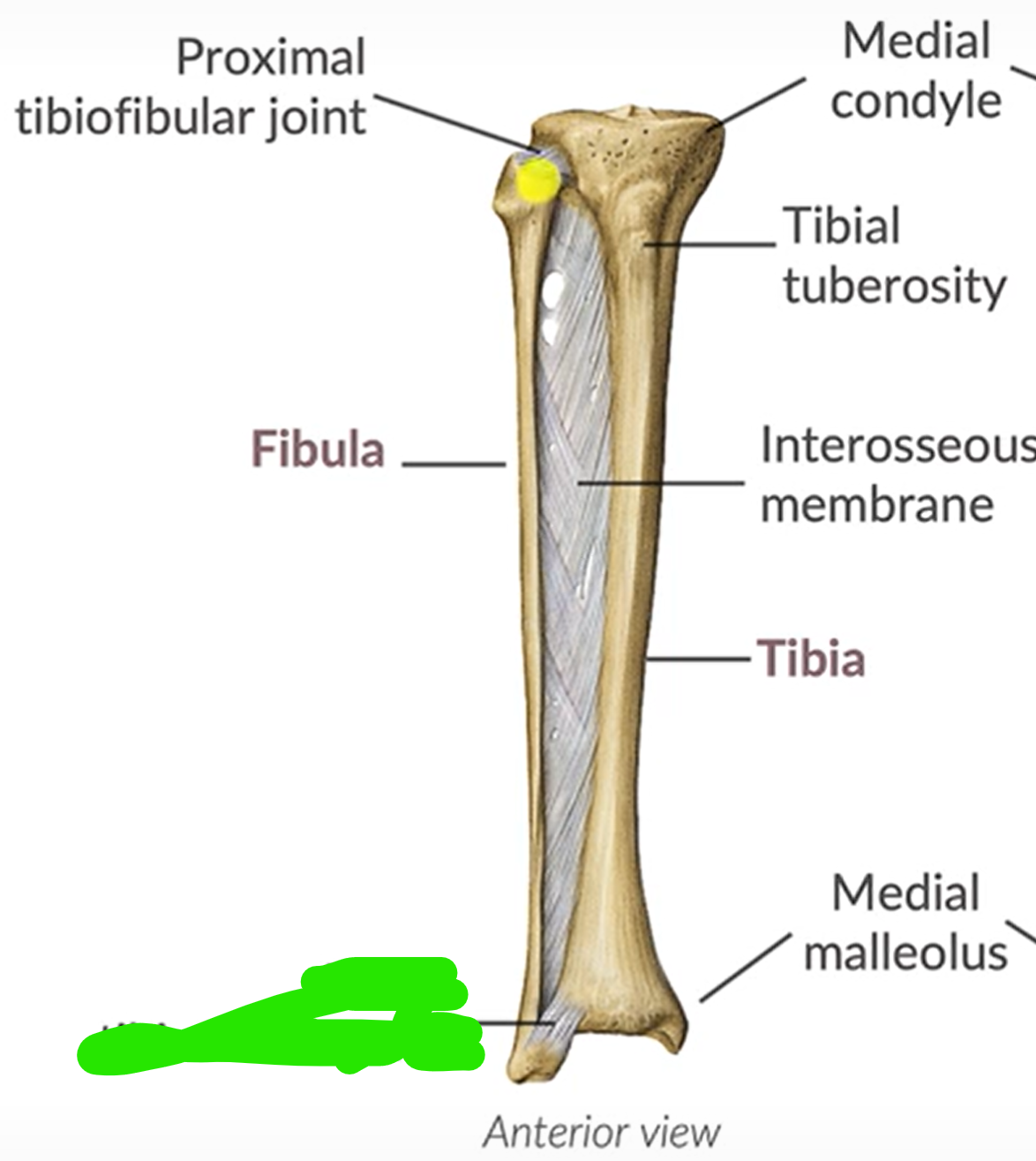term image