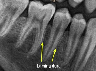 <p>Also called the alveolar process proper, the cortical plate is attached directly to this </p>