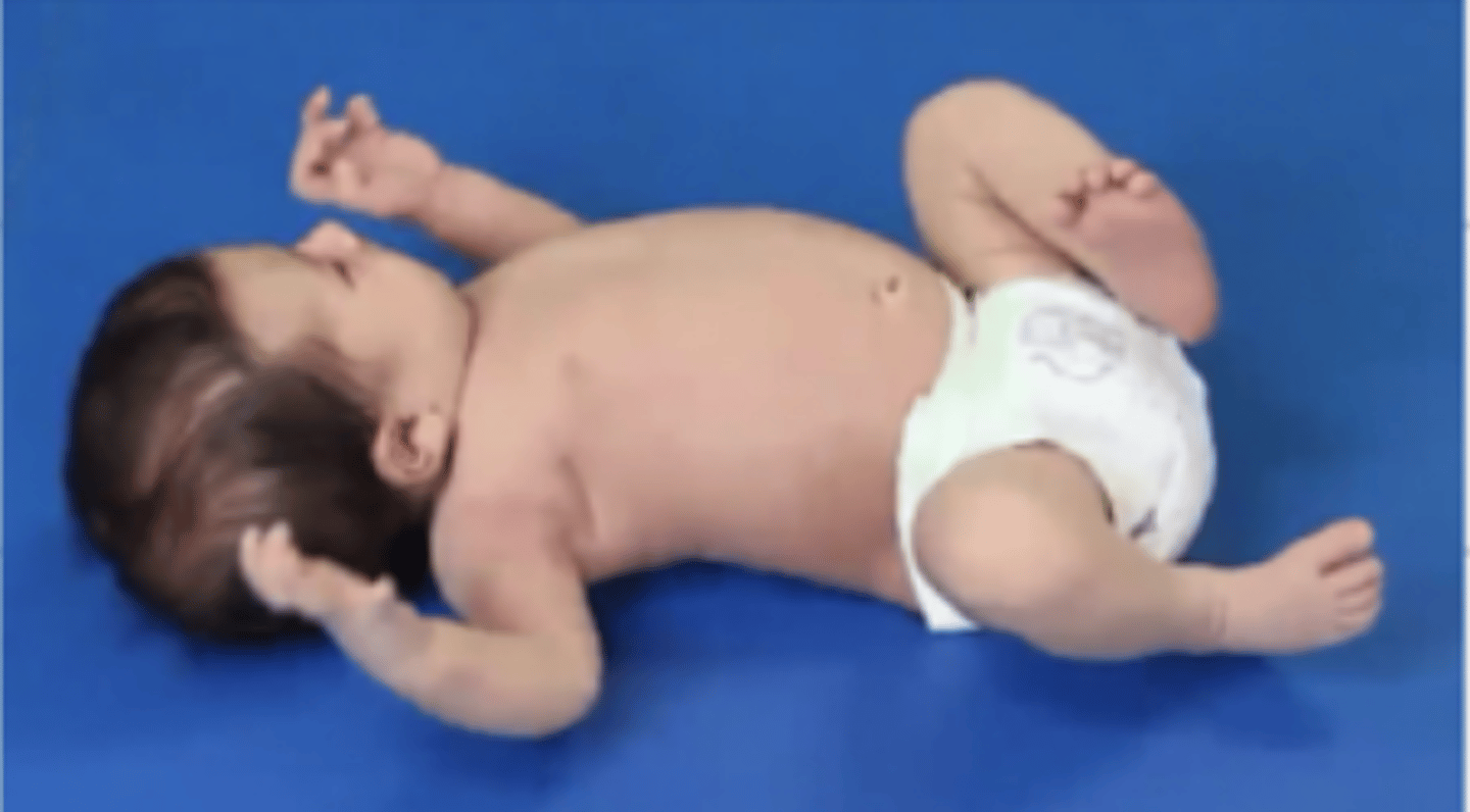 <p>Shoulder adduction and EROT</p><p>Elbow flexion</p><p>Forearm pronation</p><p>*Clenched fists</p>