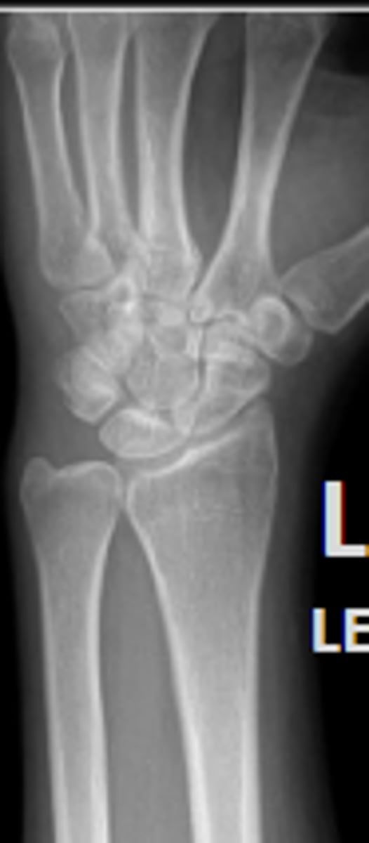 <p>What is the name of the radiographic view?</p>