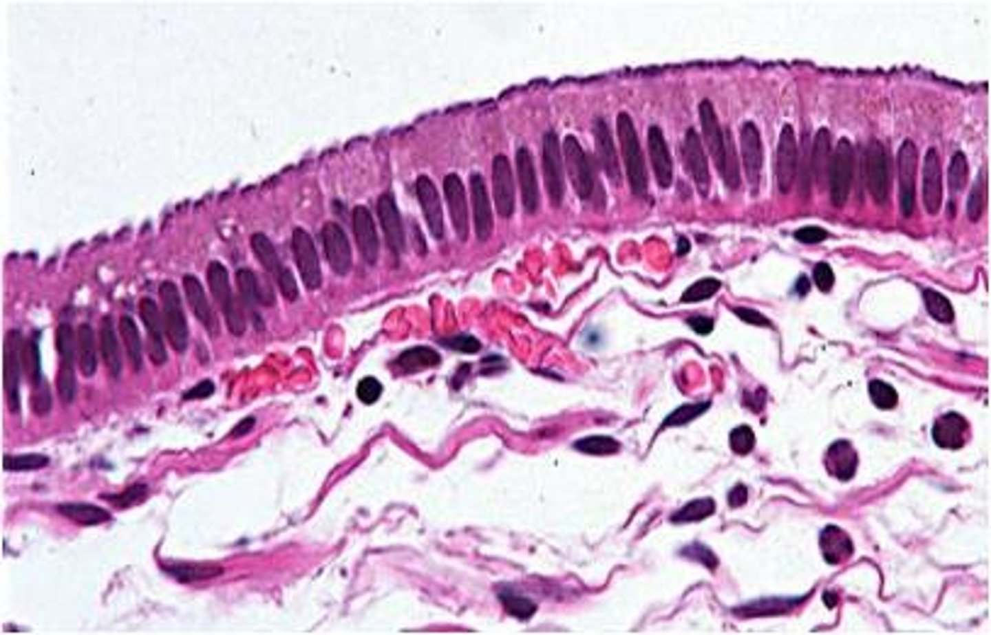 <p>- simple: one layer</p><p>- columnar: tall</p><p>- nucleus = tall, located on basal membrane side</p><p>- secretion/absorption of molecules</p><p>- digestive system, female repro tract</p><p>- ciliated = cilia located on apical surfaces (i.e. uterine tube, respiratory system)</p><p>-include interspersed cells of other kinds?</p><p>-FUNCTION: absorbs; secretes mucous and enzymes</p>