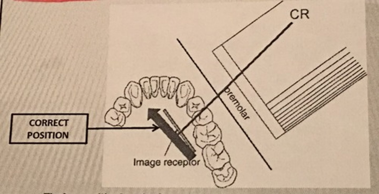 <p>-Positioning the anterior edge of the image receptor against the canine on the opposite side places the image receptor into the correct anterior position.</p>
