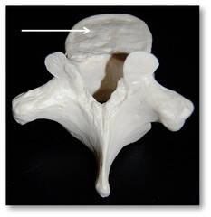 Name this specific part of the thoracic vertebra.