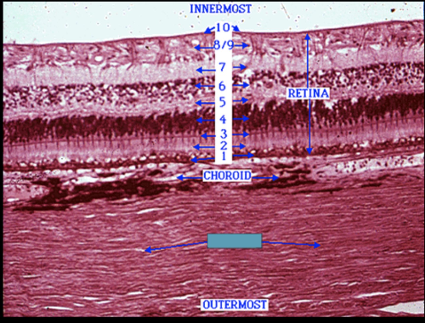 <p>Identify the layer (blue box) </p>