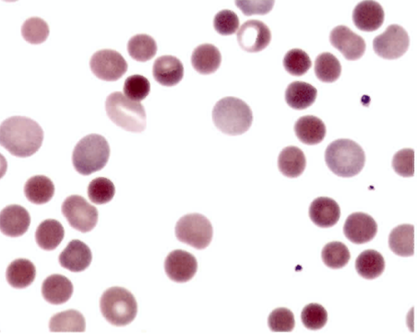 <p>C. Direct antiglobulin test</p>