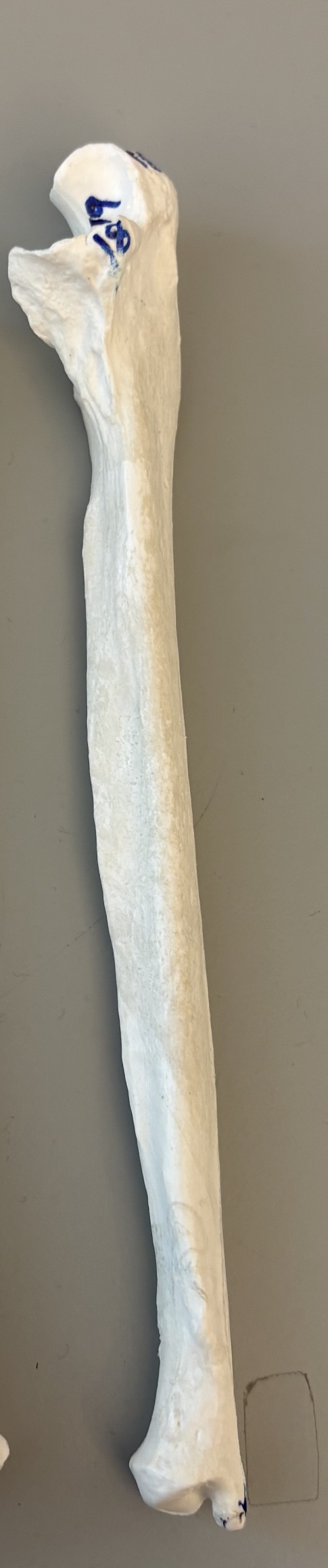 <p>what is this bone?</p>