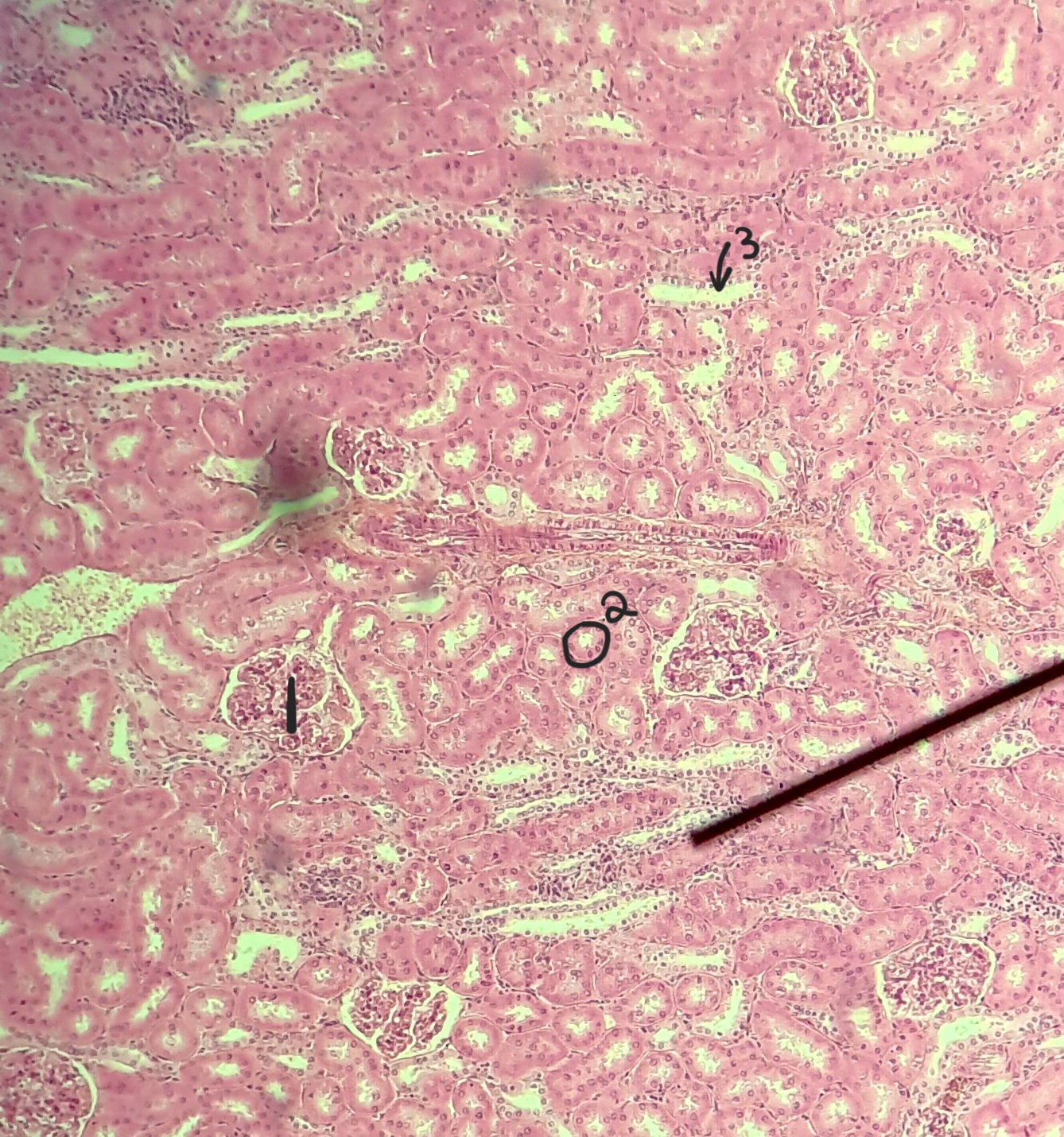 <p>what region of the kidney</p>
