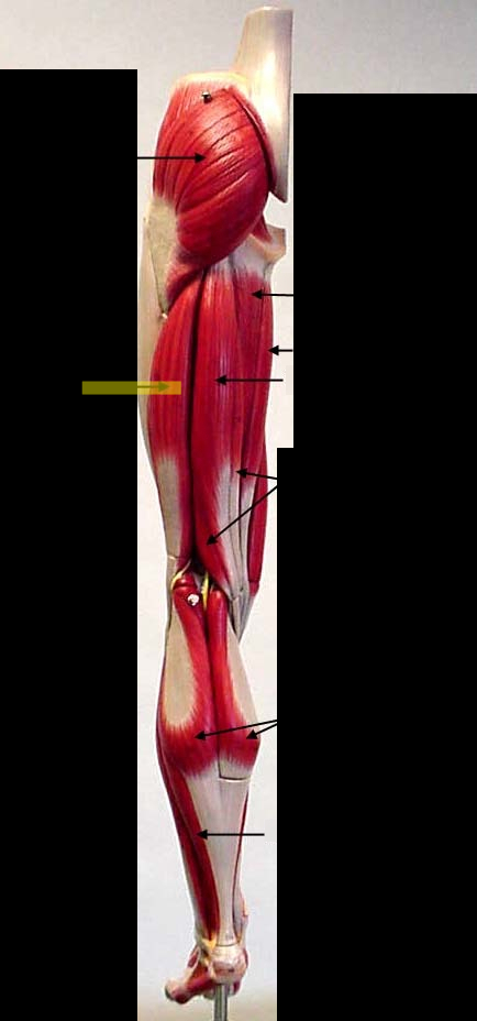 <p>What muscle is this?*****</p>
