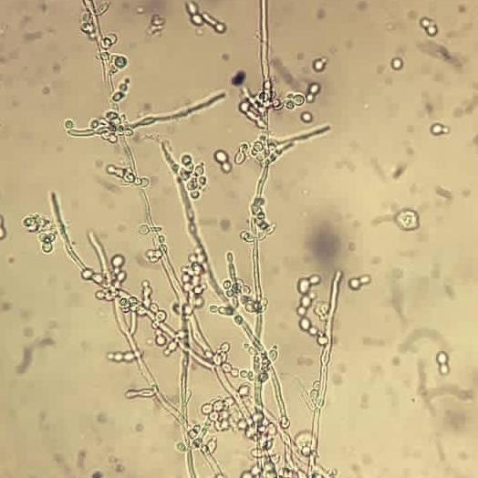 Yeast cells budding and branching out