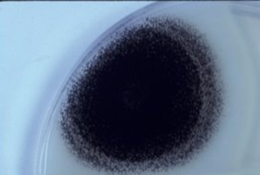 <p>Aspergillus niger</p>
