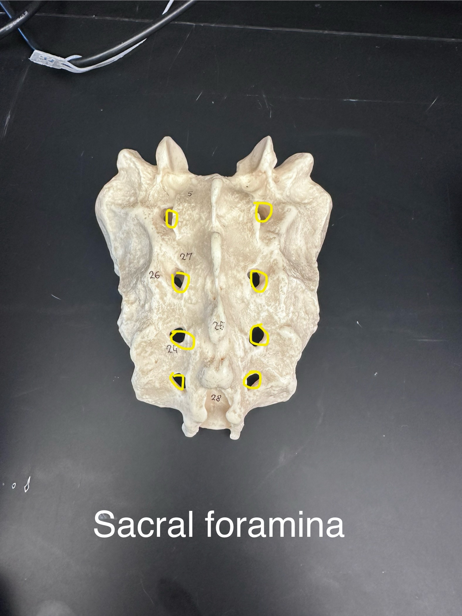 <p>Sacral Foramina</p>