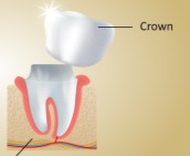 <p>crown</p>