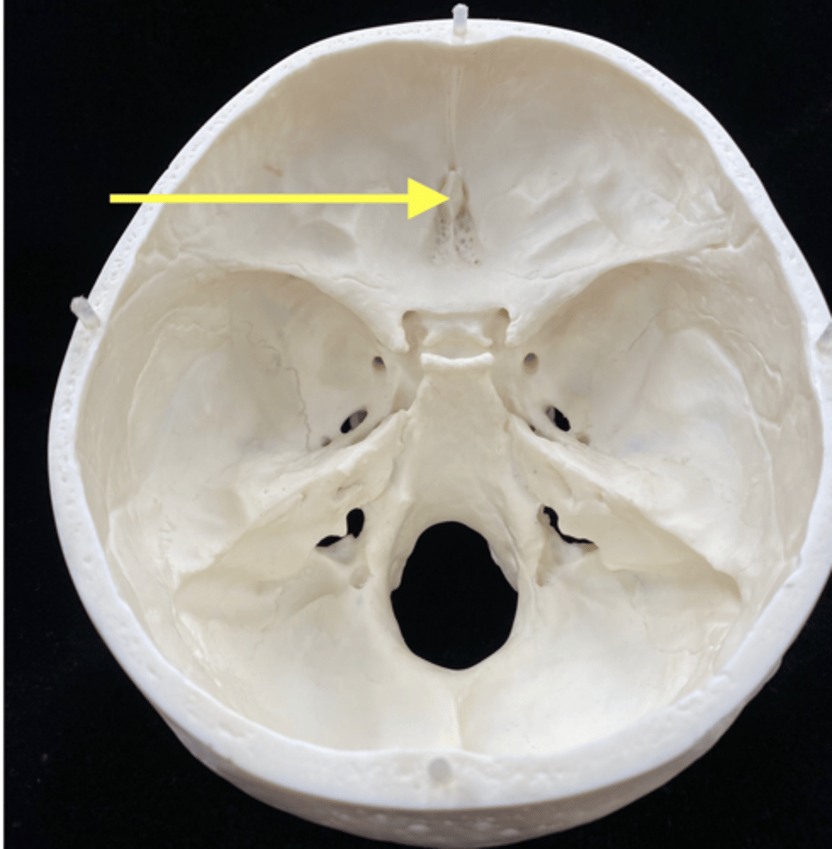 <p>name the bone and bone feature</p>