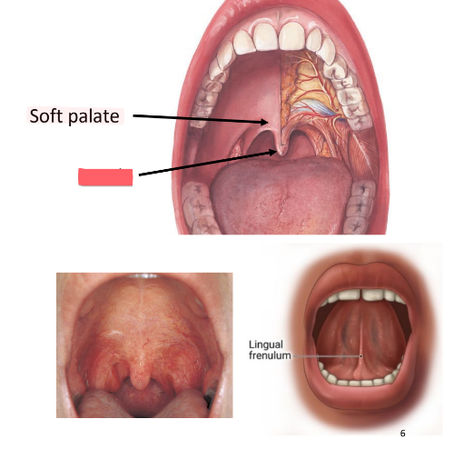 <p>cone-shaped projection of soft palate</p>