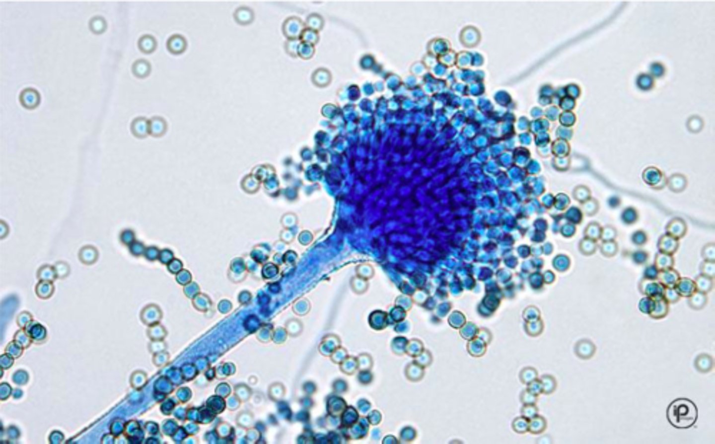 <p>Aspergillus flavus microscopic</p>