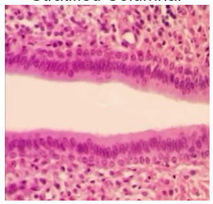 <p>kidney ducts, apical lauer is composed of columnar shaped cells</p><p>basal layer is usually cuboidal cells</p><p>large ducts of cells</p>